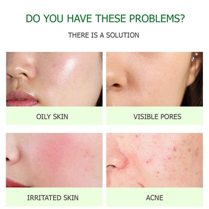 BIO AQUA ALOE VERA GEL MASK 170 G