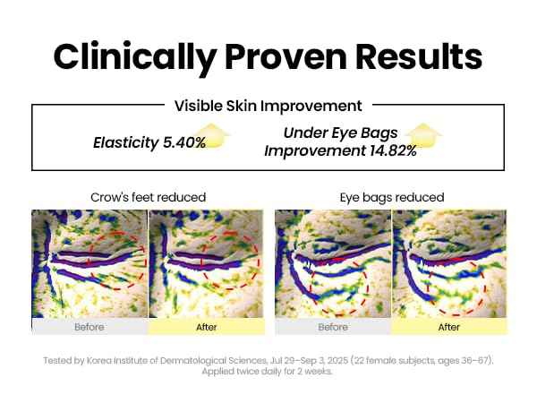 K-SECRET SEOUL 1988 Retinal Eye Cream – Formulated with Advanced Retinal